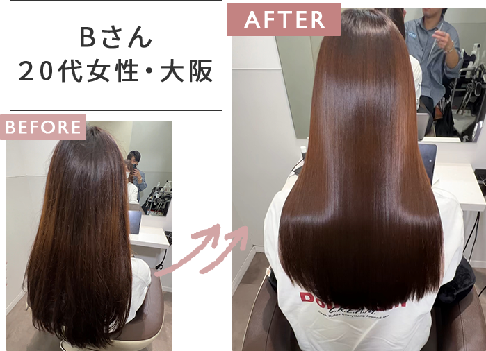 Bさん２0代女性・大阪のBefore＆After